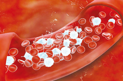 血小板减少症治疗迎来新突破！CD38单抗8周有效率达83%