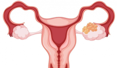 缓解率近50%！翰森制药B7-H4 ADC为卵巢癌患者带来新